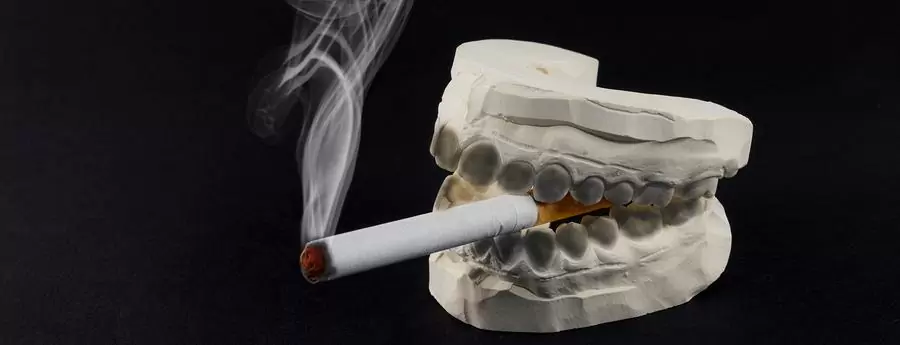 Можно ли курить после выполнения имплантации зубов?